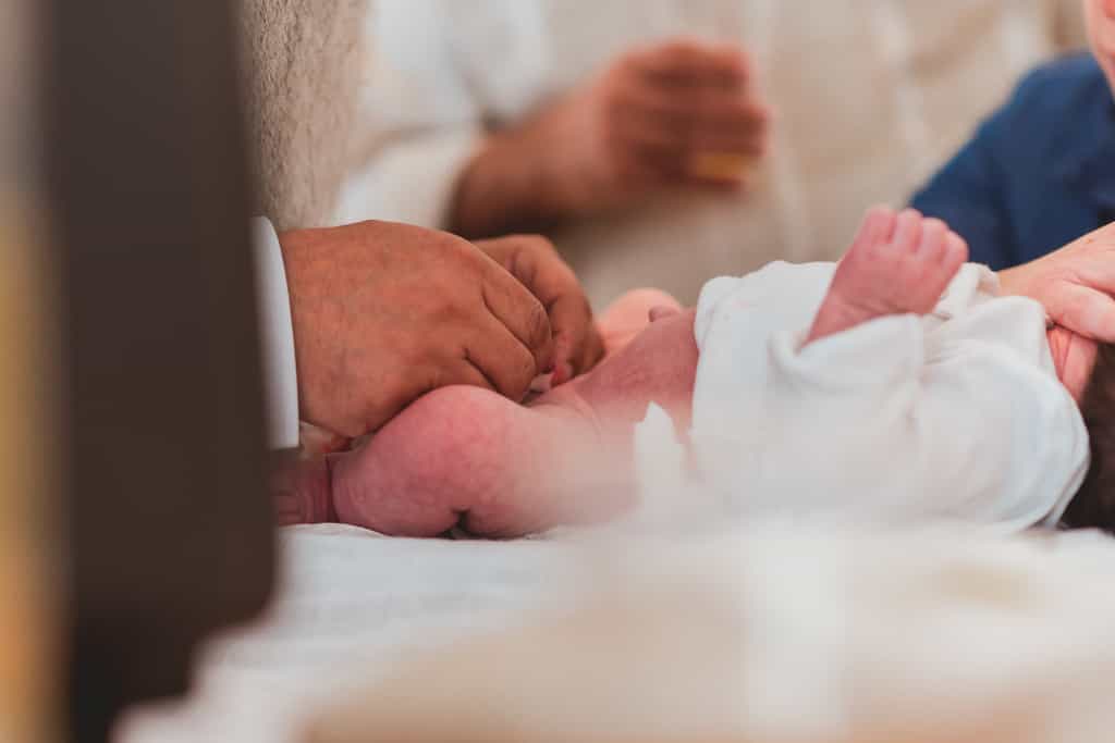 Définition Circoncision posthectomie brit milah